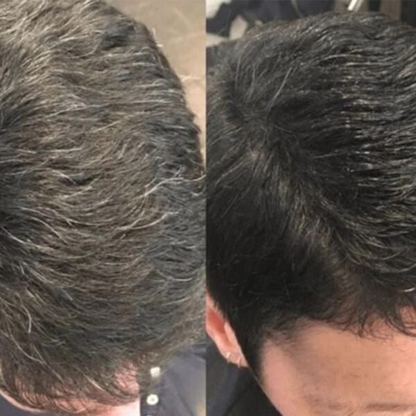 instant 10 min results